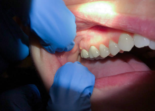 Best Emergency Dental Care for Trauma or Injury in Smith Center, KS